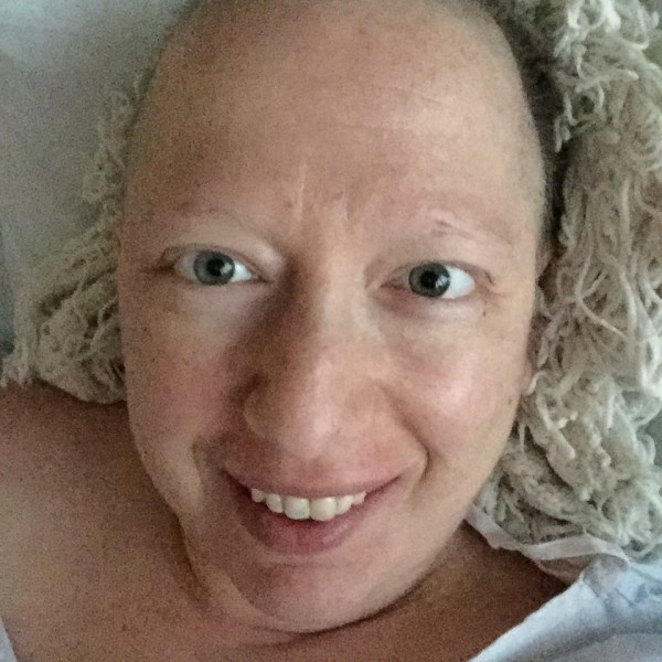 Smiling in a selfie a few hours after my surgery